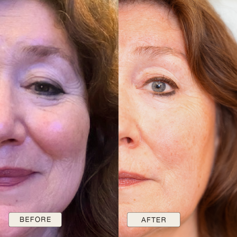 Testimonial Christiane, Before and after pictures after use of Natural Magic Skin Care range