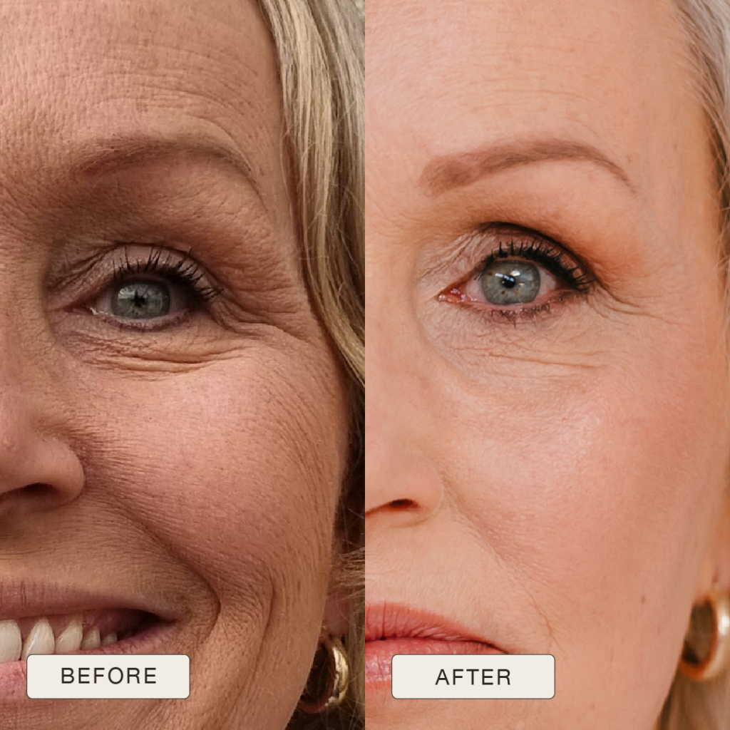 i NaturalMagic Before After Alma NL 2025