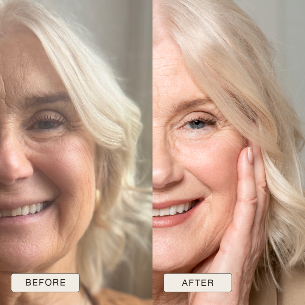 i NaturalMagic Before After Anna 2025 10