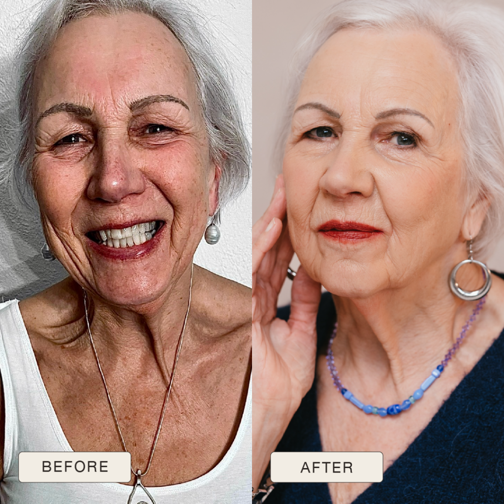 i NaturalMagic Before After Antoinette 2025 13