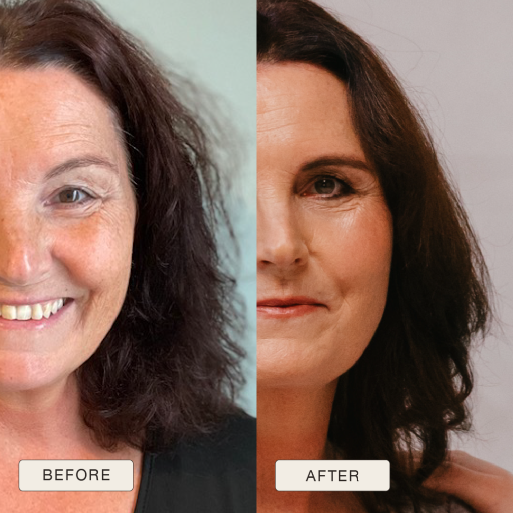 i NaturalMagic Before After Barbara 2025 14