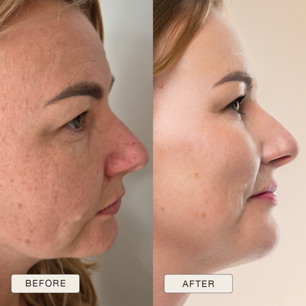 i NaturalMagic Before After Beata PL 2025