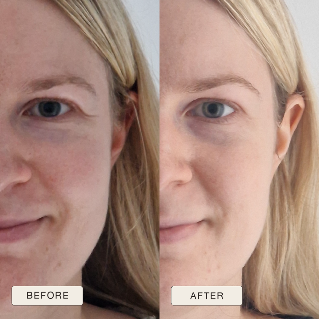 i NaturalMagic Before After Celine FR 2025