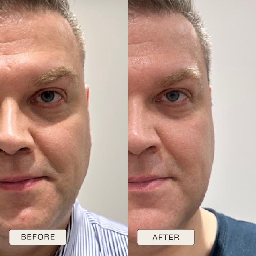 i NaturalMagic Before After Eugenijus 2025 copy