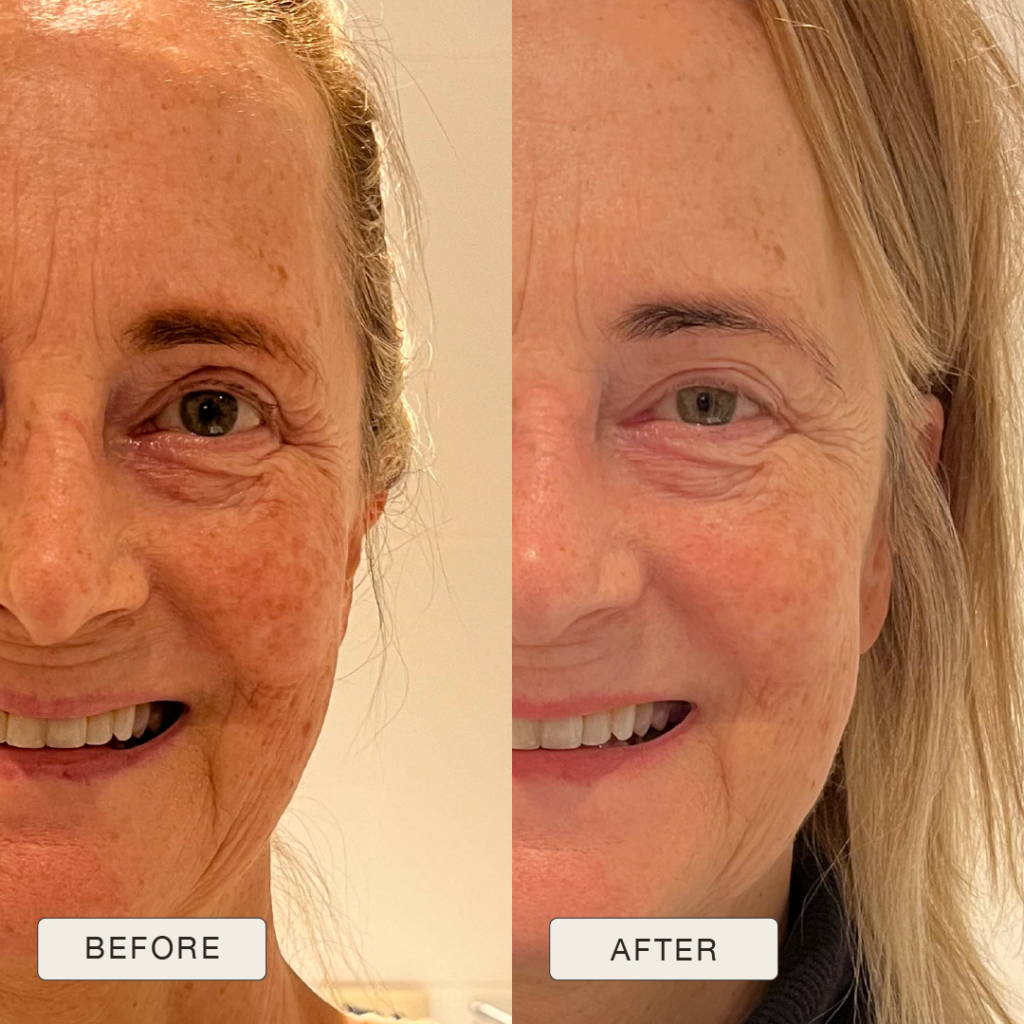 i NaturalMagic Before After Helga 2025