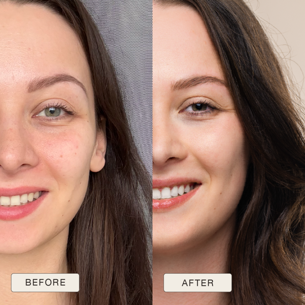 i NaturalMagic Before After Karolina 2025 12