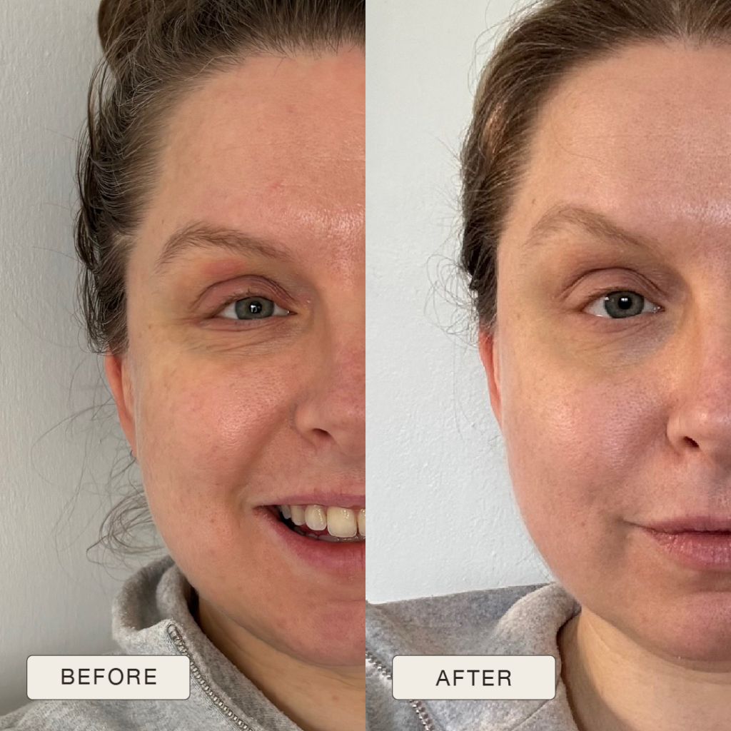 i NaturalMagic Before After Laura 2025