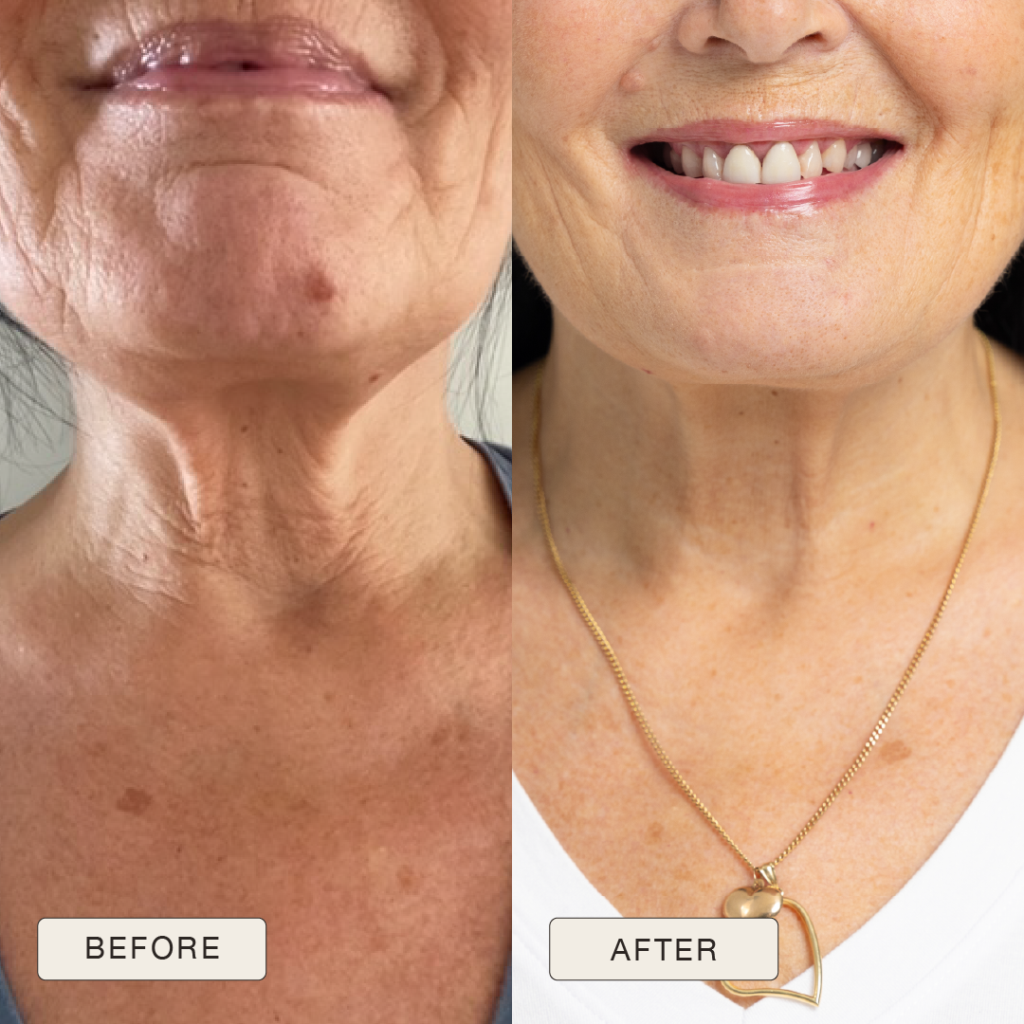 i NaturalMagic Before After P ivi 2025 11