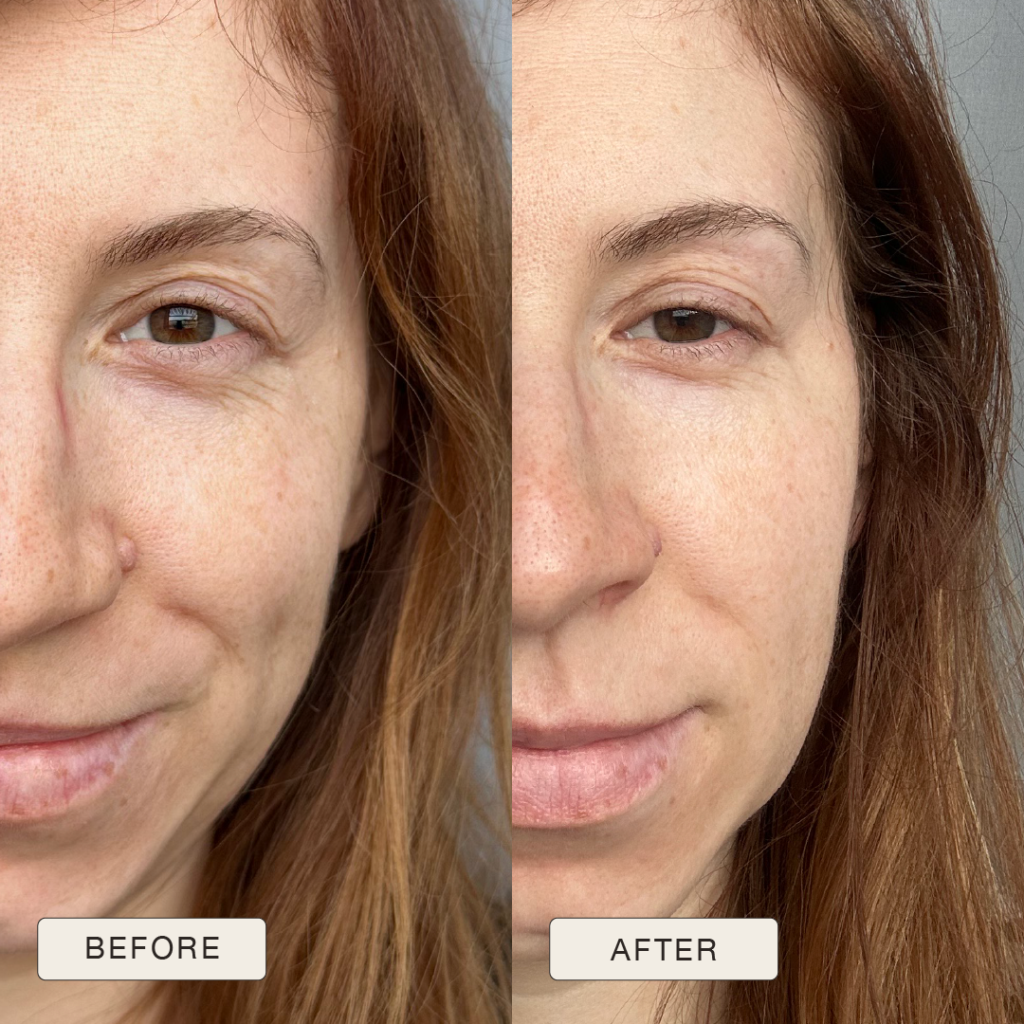 i NaturalMagic Before After Patryija PL 2025