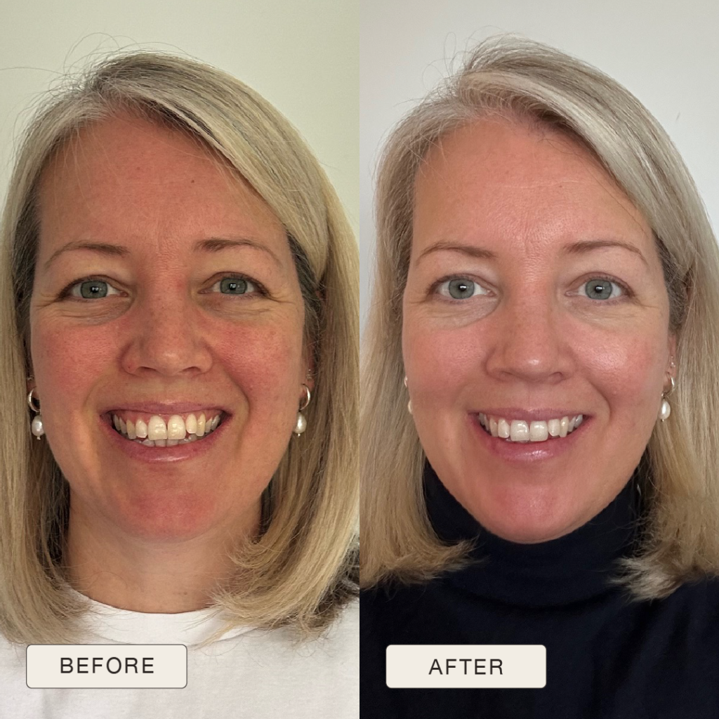 i NaturalMagic Before After Rebecca 2025