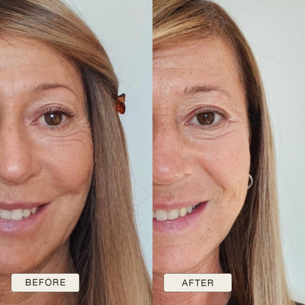 i NaturalMagic Before After Rossanna 2025 09