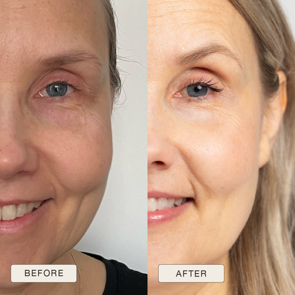 i NaturalMagic Before After Teija FI 2025