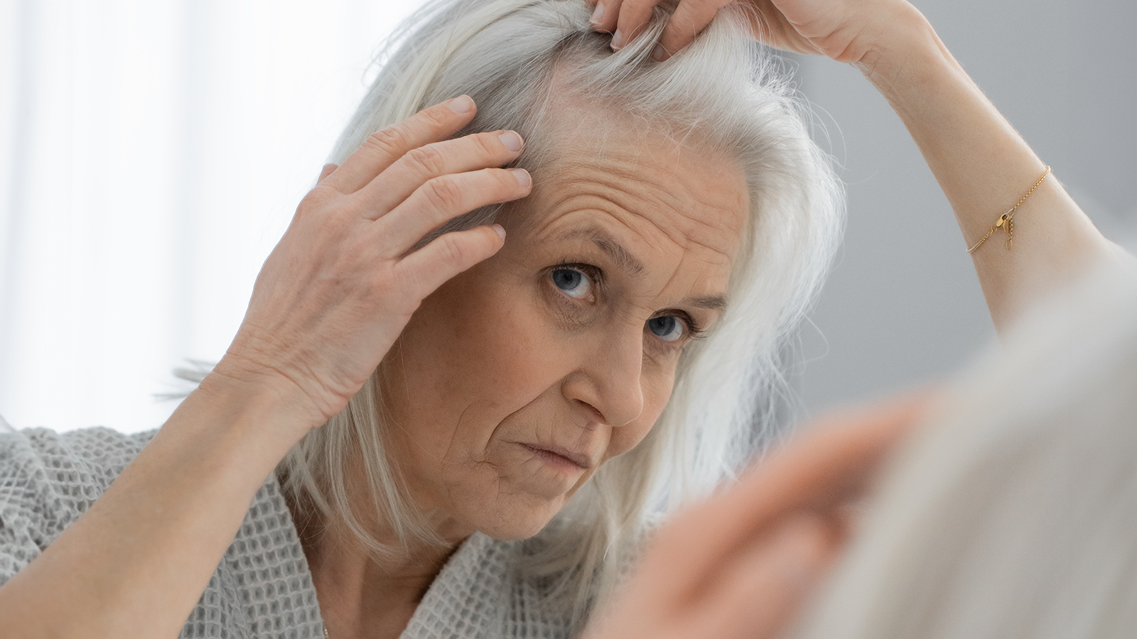 Tyndt hår i overgangsalderen? 14 hairloss olderlywoman